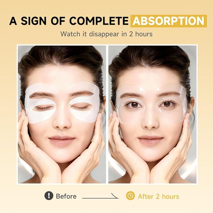 8 Pairs 5% PDRN Under Eye Patches, 6-in-1 Bio-Collagen 360° Eye Patches for puffy eyes, dark circles & Wrinkle | 2% Caffeine, Kojic acid, Retinol, Hyaluronic, Niacinamide | Korean Popular Eye Care