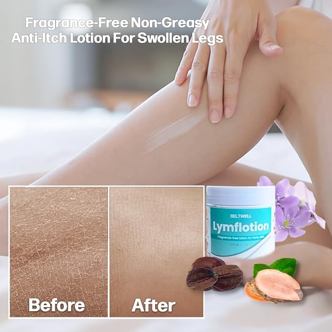 Beltwell® Lymflotion Non-Greasy Moisturizer for Dry & Sensitive Skin Relief – Fragrance Free Anti-Itch Lotion for Itchy Skin, Lymphedema, Diabetes, Eczema, Cracked Feet & Arms – 200ml