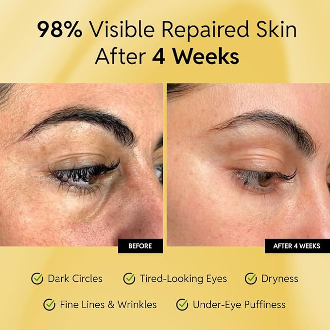 Korean Repair Eye Cream - Restores and Strengthens Delicate Under-Eye Skin - With Ceramides and Caffeine - Reduces Fine Lines, Wrinkles and Puffiness - Fast-Absorbing - Dermatologist-Tested - 15ml
