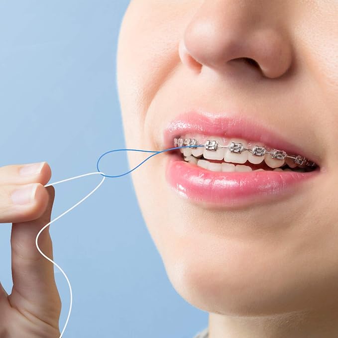 150 Count Floss Threaders for Braces, Bridges, and Implants (3 Packs of 50) - Flexible Nylon Threading Loops - Slim & Durable Dental Floss Helpers for Crowns & Orthodontic Appliances