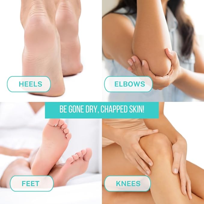 Onyx Professional Cracked Heel Repair Balm Stick for Dry Cracked Feet Treatment, Tea Tree Scent, 2 pack - Moisturizing Foot Balm, Rolls On, No Mess Like Foot Cream or Foot Lotion, Heel Treatment