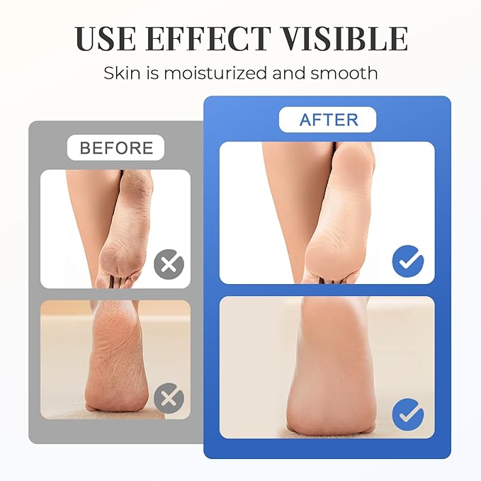 Hydrating and Anti-Cracking Foot Cream, 2025 Moisturising and Relieves Cracking and Dryness Foot Cream, Hand and Foot Repair Cream for Women & Men Callused, Feet, Knee, Elbow, Hand (Pink-1PC, #01)