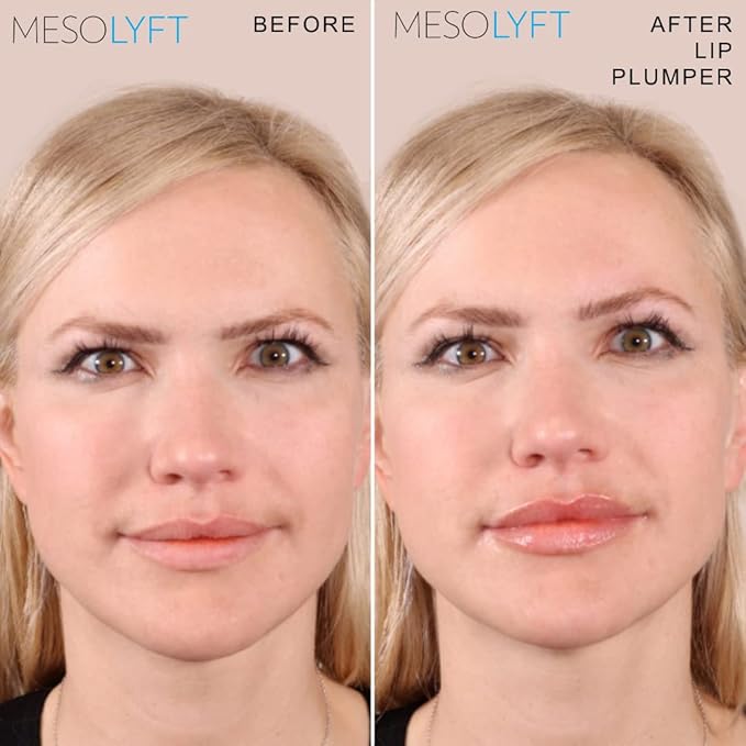 Neck & Lip Plumper Combo Plumping