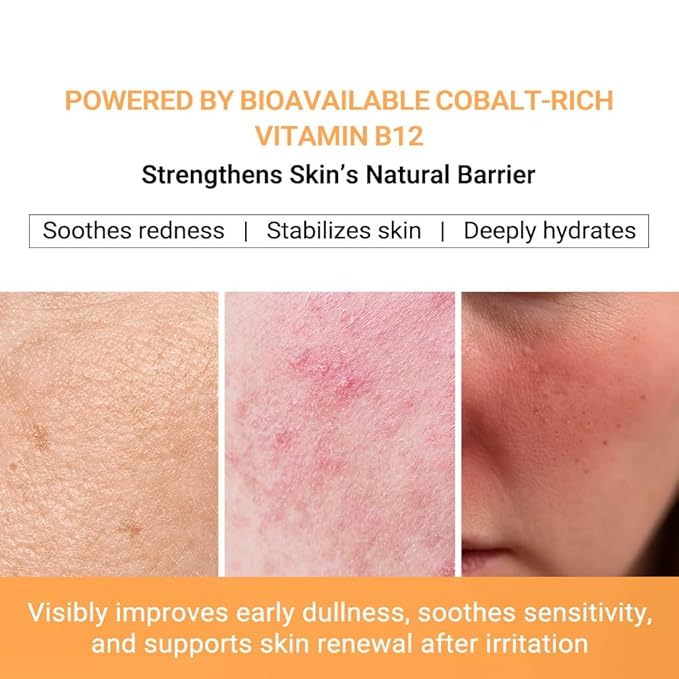 pure.tiful Vitamin B12 Lotion (1 oz) | Repair & Hydrating Cream for All Ages （teen & adult| Soothes Redness, After-Sun Skin Relief, Strengthens Barrier, Sensitive Skin Safe