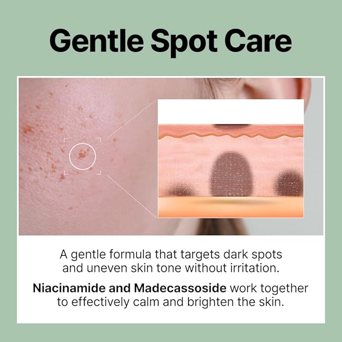 FRANZ Invisible Dark Spot Pimple Patch for Acne Marks, Ultra-Thin Makeup-Friendly Spot Treatment with UV Protection – 12 Patches