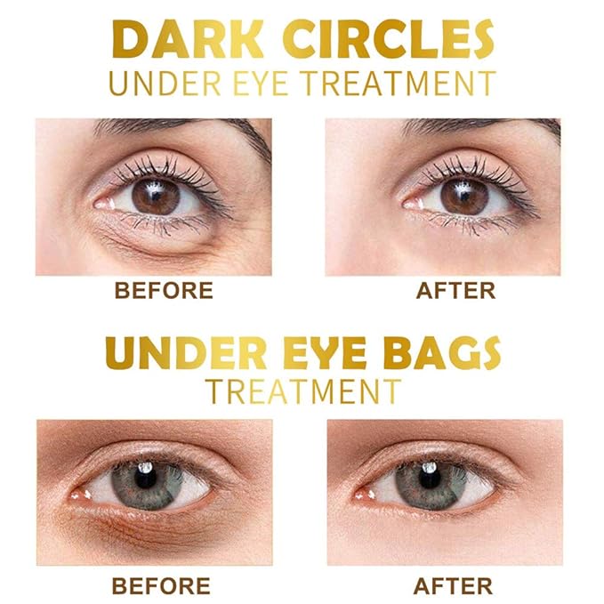 Felico Under Eye Patches, 30 Pairs Gold Eye Mask, Eye Gel Pads With Collagen Treatment for Reducing Dark Circles, Lighten Wrinkles Anti-Aging Moisturizing, Fine Lines Eye Bags Puffiness for Women Men