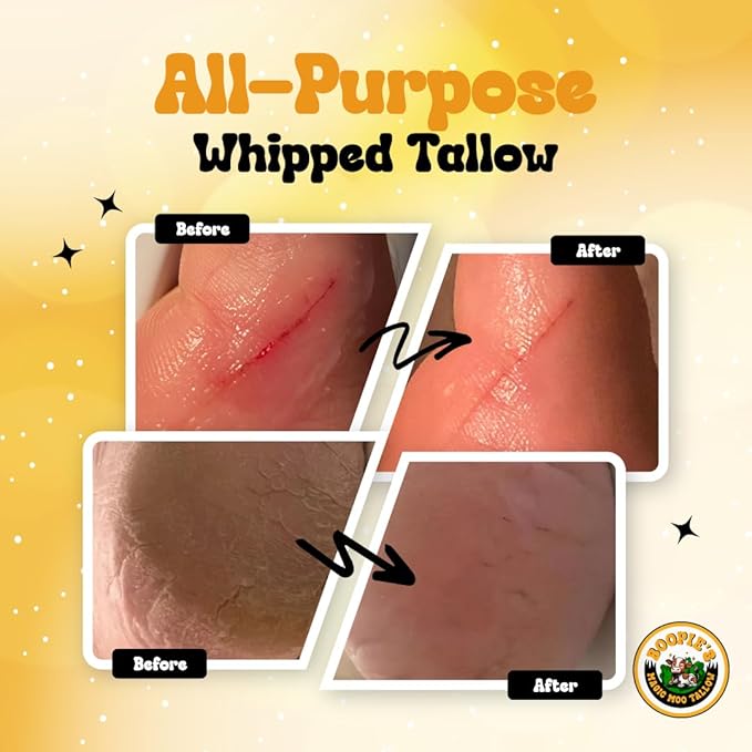 Magic Moo All Purpose Whipped Tallow Skincare for acne, eczema, dry skin, moisturizer, stretch marks & hydration. Now with organic emu oil. All organic ingredients.