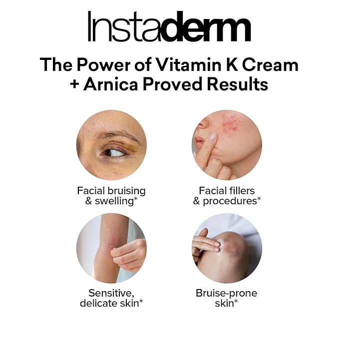 Instaderm Vitamin K Cream- Bruise Healing Formula with Arnica. Dark Spot Moisturizer for Bruising, Spider Veins & Broken Capillaries. Repair Under Eye Dark Circles, & Puffiness.