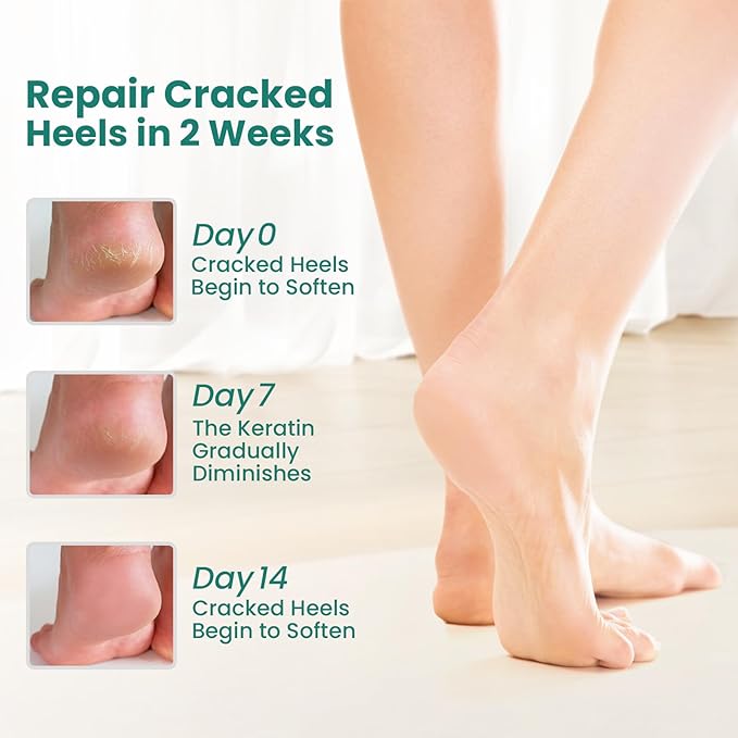 Welnove Moisturizing Heel Socks - 3 Pairs Aloe Vera Extract Infused Gel Lining for Dry Feet - Cracked Heel Repair Treatment - Cotton Socks for Women Men Foot Care (Includes Foot File, Extra Large)
