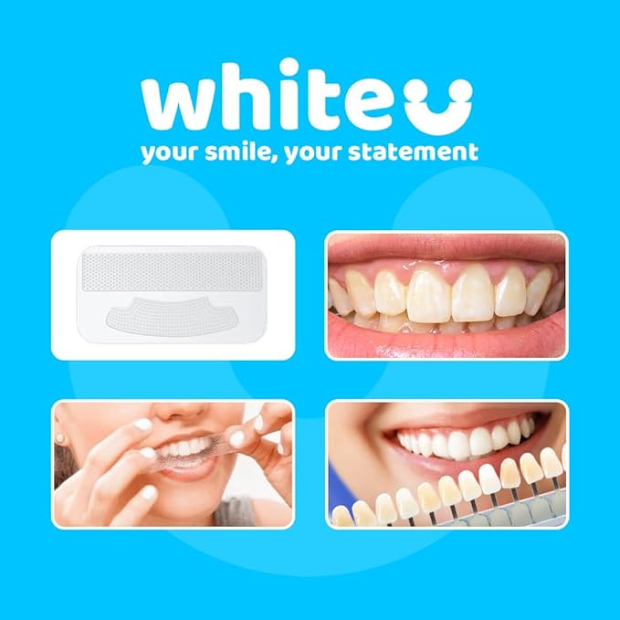 Teeth Whitening Strips for Sensitive Teeth - Peroxide Free No Sensitivity - 14 Strips with Pap+ & Nano Hydroxyapatite - Enamel Safe Whitening in 7 Days - WhiteU