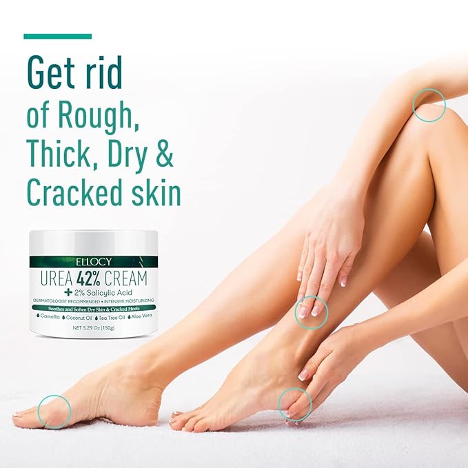 Urea cream 40 perent for feet: Maximum Strength Urea lotion -For Callus and Cracked Heels Treatment-Rough Thick Skin for foot- Crema 5.29 oz.(150g)