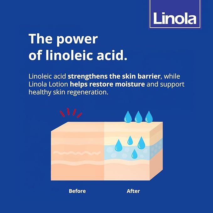 Linola Lotion - Body Lotion with Essential Linoleic Acids - for the Daily Care of Dry & Stressed Skin - Protects & Regenerates Dry Skin - Made in Germany - Vegan - 200 ml (6.8 Fl Oz)