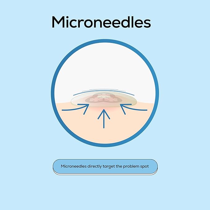 Hanhoo EraseZit Magnesium Microneedle Patch, 8 Microneedle Patches, Hydrocolloid Pimple Patches, For Deep Pimples, Calms Angry Zits, Acne Spot Patches, Microdot Pimple Patches, Korean Skincare