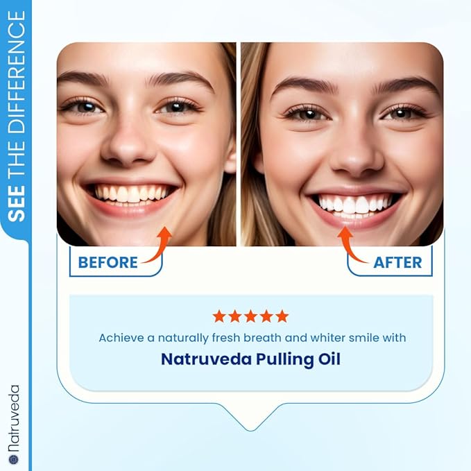 Coconut Oil Pulling Mouthwash – Natural Whitening Ayurvedic Rinse | Fresh Mint Blend | Coconut Oil Pulling for Teeth & Gums | Whyte Oil Pulling | Aceite de Coco para Los Dientes -10 oz