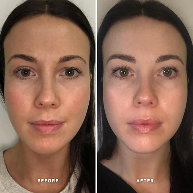 Alpha-H Vitamin B Serum With 5% Niacinamide - Daily Hydration For Balanced, Calm Skin - Helps Smooth Texture, Reduce Shine, And Support Your Skin Barrier
