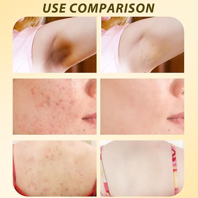 2PCS Bee Venom Comprehensive Cream,Bee Venom Skin Care Cream，Advanced Bee Venom Therapy Cream for All Skin Types