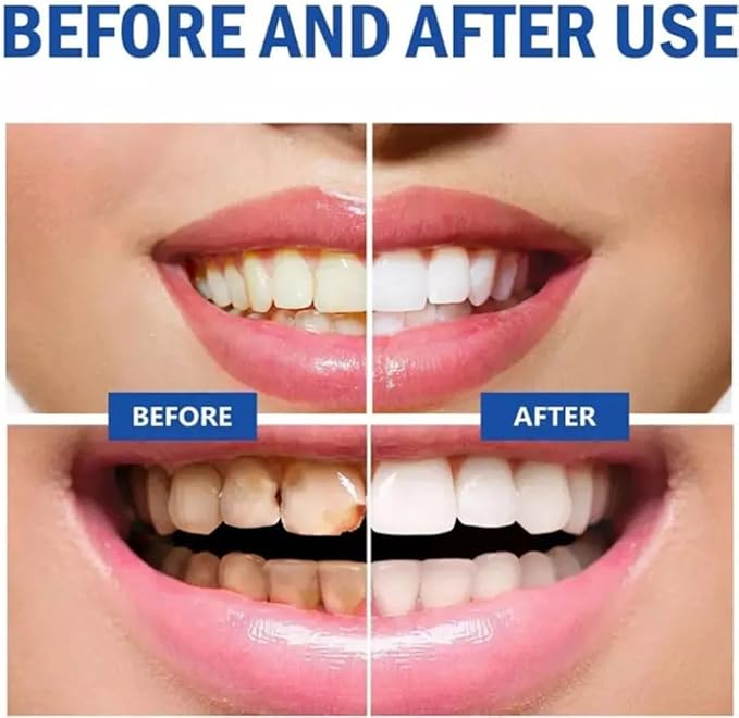 SP 10 Probiotic Toothpaste for Whitening & Gum Health – Natural Fluoride-Free Formula for Fresh Breath & Oral Hygiene