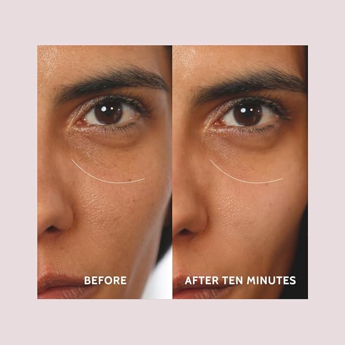 Infuse AWARD WINNER Peptide Eye Cream for Dark Circles, Puffiness & Fine Lines | Yerba Mate Fast-Acting Formula for Women in Their Prime