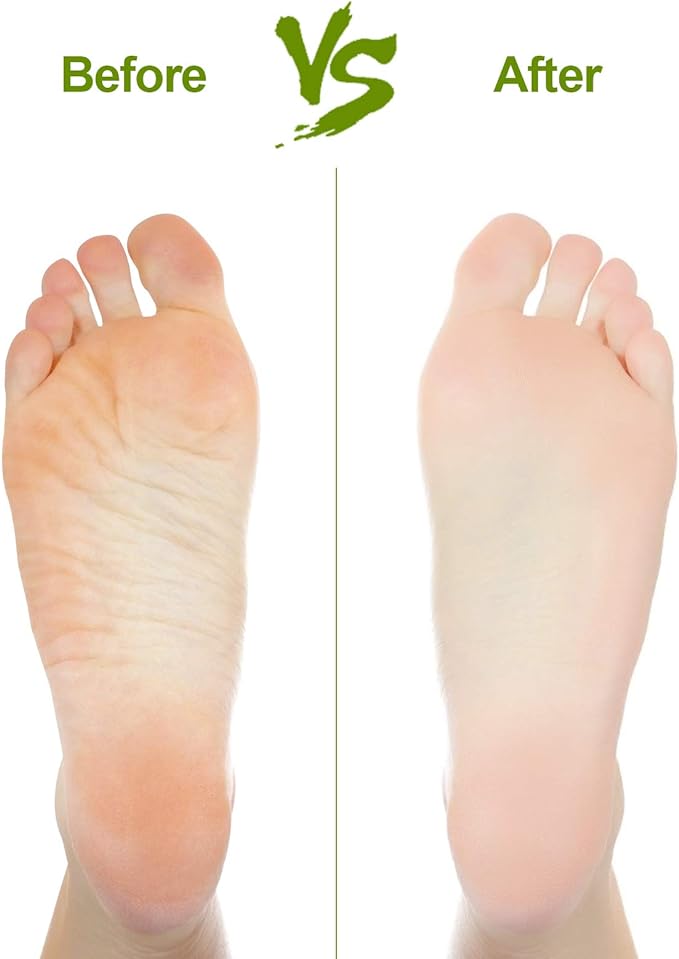 2PCS Natural Pumice Stone, Asqraqo Lava Pedicure Tools Hard Skin Callus Remover for Feet and Hands - Foot File Exfoliation to Remove Dead Skin, and Callusess