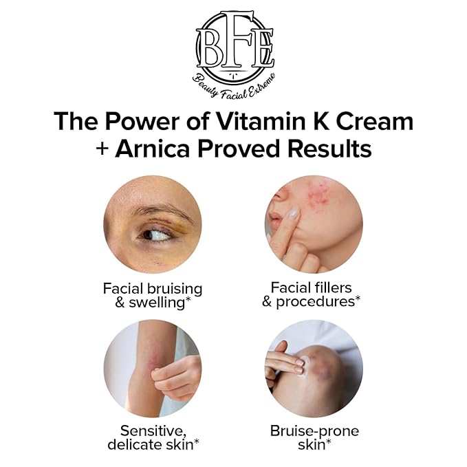 Vitamin K Cream- Moisturizing Bruise Healing Formula. Dark Spot Corrector for Bruising, Spider Veins & Broken Capillaries. Reduces Under Eye Dark Circles, Fine Lines, Puffiness, & Wrinkles.