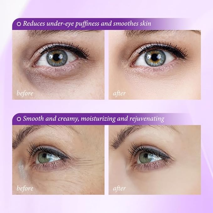 GMFRDGT Eye Cream, Reduce Wrinkles and Fine Lines, Moisturizing, Pro-Xylane Active Anti-Wrinkle Eye Cream, Eye Care