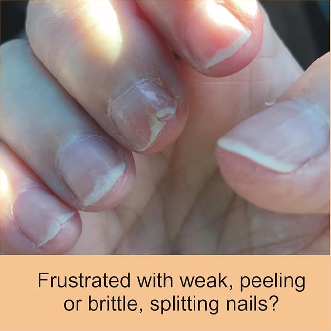 Penetrating Fingernail Conditioner and Strengthener