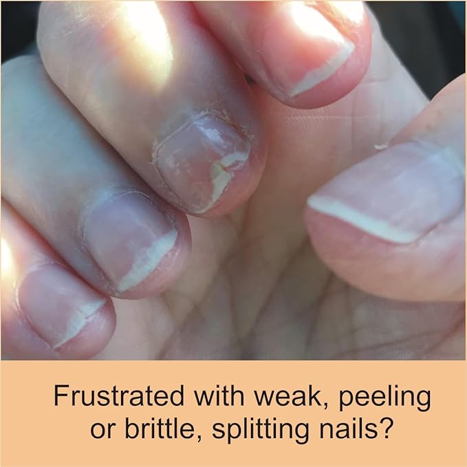 Penetrating Fingernail Conditioner and Strengthener
