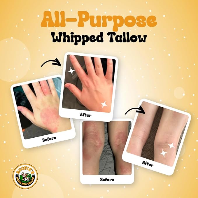 Magic Moo All Purpose Whipped Tallow Skincare for acne, eczema, dry skin, moisturizer, stretch marks & hydration. Now with organic emu oil. All organic ingredients.