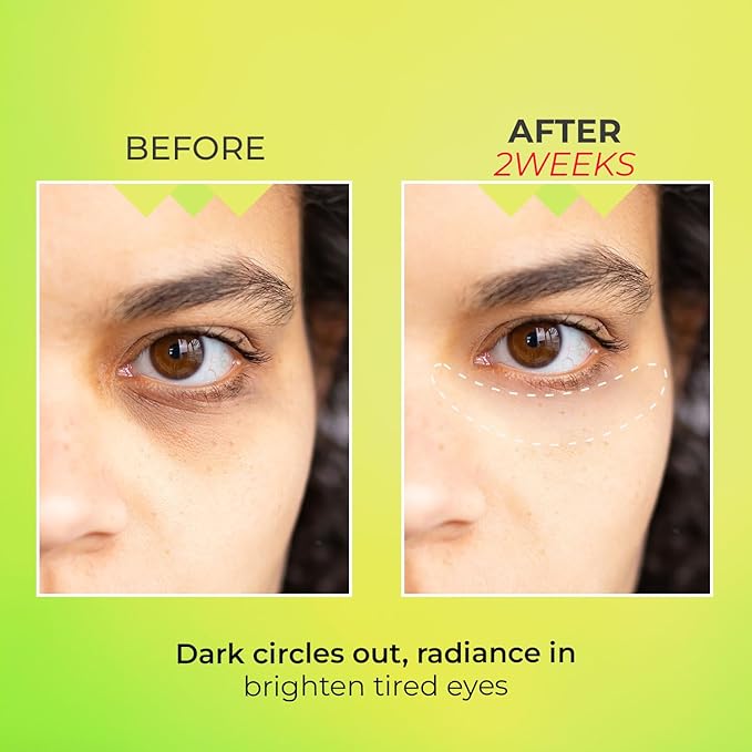 KSBC Look at Me Teen Again Dark Circle Eye Cream, Anti-Aging Line Smoothing Skin Care Treatment, Wrinkle Care, Cruelty Free, for Women and Men 0.84 fl. oz 25 ml