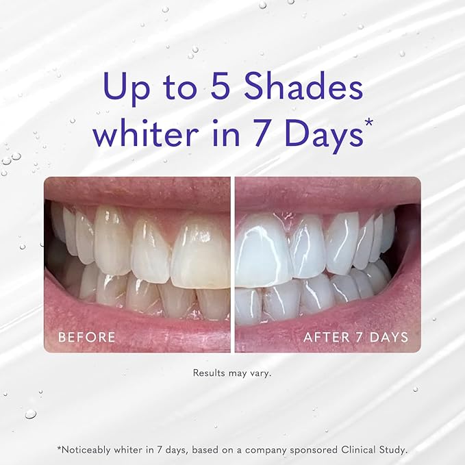 Smileactives Teeth Whitening Gel for Toothpaste with Clinical-Grade Hydrogen Peroxide, Tooth Stain Remover for White Teeth, Dentist Quality Pro Whitening Gel to Remove Coffee Stains, 3 Pack, 1 oz
