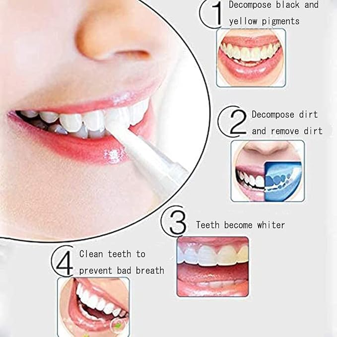 10 pcs Teeth Whitening Gel Pen 2ml Oral Cleaning Pen, Safe 44% Carbamide Peroxide Gel, 20+ Uses, Effective, Painless, No Sensitivity, Travel-Friendly, Natural Mint Flavor
