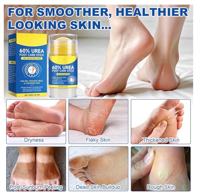 60% Urea with 2% Salicylic Acid Urea Foot Care Stick, Foot Cream Moisturizer for Dry Cracked Feet, Knees, Elbows, Hands,Moisturizes and Hydrates the Dry Skin,Callus Remover & Skin Softener -1.41oz