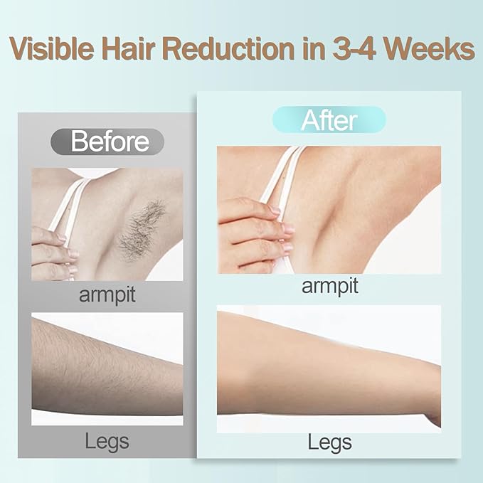IPL Hair Removal Device, Portable Permanent Hair Reduction for Men and Women, Home Hair Remover with Razor and Glasses, 999,999 Flashes, Underarms Back Legs Arms Face Bikini Line