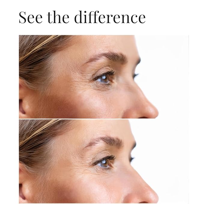 ljörk Dark circles under eye treatment | Eye Cream Anti Aging. Formulated for Dark Circles, Bags under the Eyes and Reducing Wrinkles.