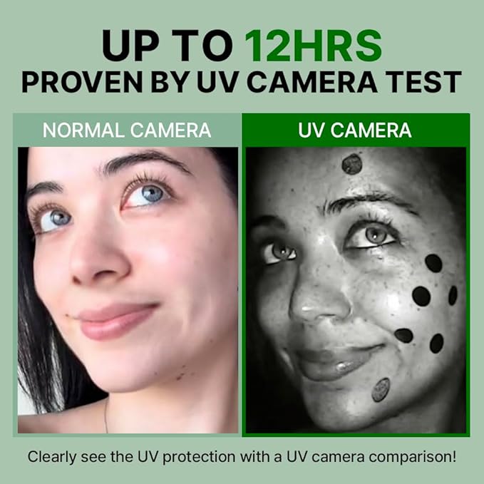 FRANZ Invisible Dark Spot Pimple Patch for Acne Marks, Ultra-Thin Makeup-Friendly Spot Treatment with UV Protection – 12 Patches
