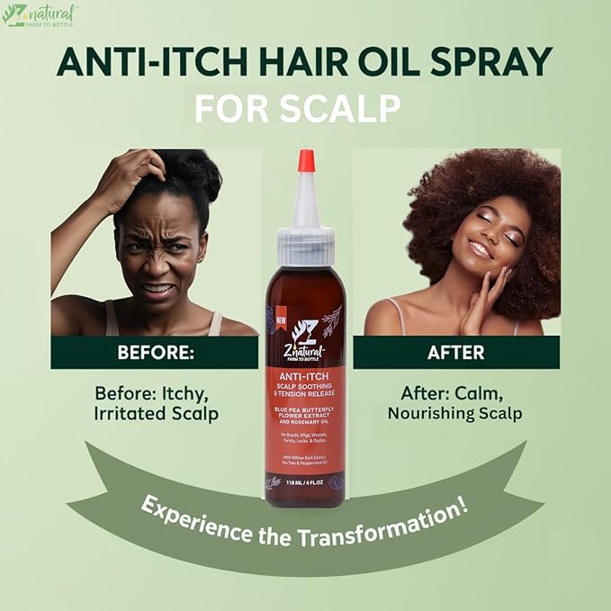 Z’natural Scalp Oil for Dry Itchy Scalp | Anti Dandruff Hair Growth Oil | Natural Ingredient Rosemary, Aloe Vera, Blue Pea Butterfly & Willow Bark | Anti-Itch Relief with Cruelty Free Formula – 118 ml