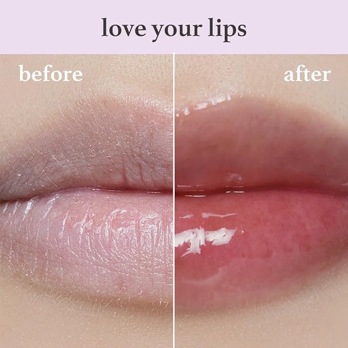 NOONI Korean Hydrating Lip Oil - Applefig | Long-Lasting, Moisturizing, Plumping, Revitalizing for Dry Lips, Waterproof, No Peel Off, Hydrating, Nourishing Crystal Clear, 0.12 FL Oz