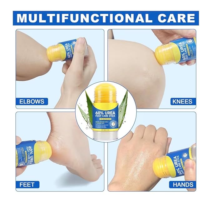 60% Urea with 2% Salicylic Acid Urea Foot Care Stick, Foot Cream Moisturizer for Dry Cracked Feet, Knees, Elbows, Hands,Moisturizes and Hydrates the Dry Skin,Callus Remover & Skin Softener -1.41oz