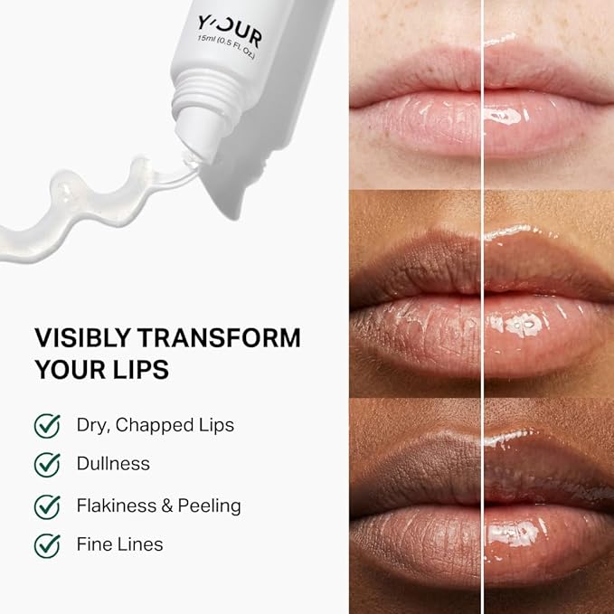 Y’OUR Intensive Healing Lip Balm for Dry Chapped Lips - Deeply Hydrating Lip Treatment with Hyaluronic Acid, Shea Butter & Rosehip Oil - Repairing Moisturizer, Paraben & Silicon-Free, Gifts for Women