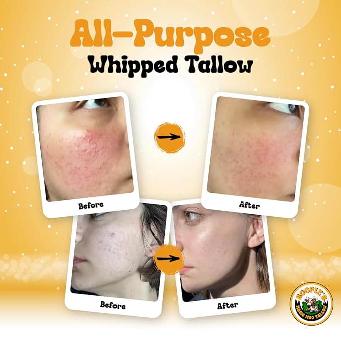 Magic Moo All Purpose Whipped Tallow Skincare for acne, eczema, dry skin, moisturizer, stretch marks & hydration. Now with organic emu oil. All organic ingredients.