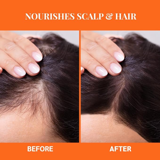 Well's Oil Batana Oil | 2 fl. oz. | 100% Natural | Strengthens, Hydrates & Nourishes | For All Hair Typess (2 fl. oz. / 59 ml)