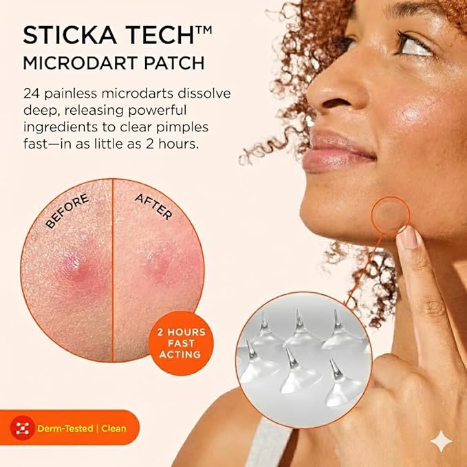 ZitSticka Extra Strength Killa Acne Patches for Face - World's Most Potent Pimple Patch with Fast-Acting Microdarts - Starts Working within 2 Hours for Deep, Early-Stage Zits & Blemish - 4 Count