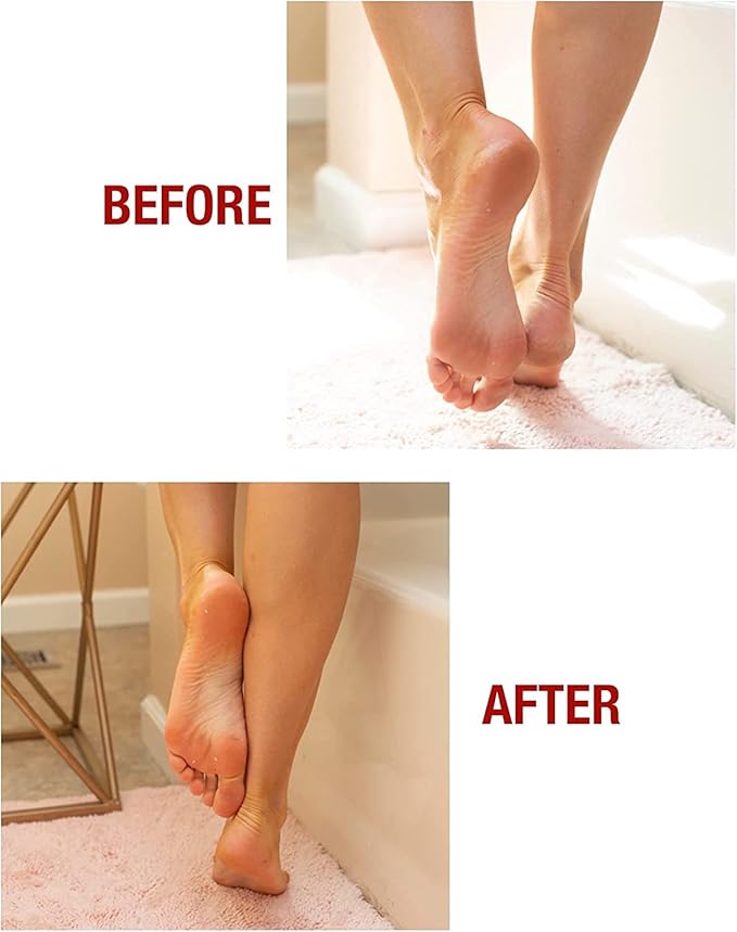 Kerasal Intensive Foot Repair Skin Healing Ointment, 1 Oz and Moisturizing Gel Socks, One Pair (Packaging May Vary)