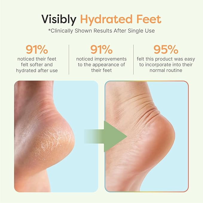 ZenToes Moisturizing Socks for Cracked Heel Treatment, Vitamin E, Olive Oil and Jojoba Oil Infused Heel Socks, Galentines Day Gifts, Self Care Gifts for Women (White & Blue Snowflake, Regular)