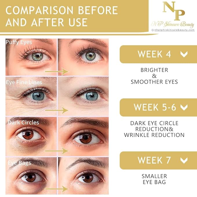 NP Skincare Beauty Anti-Wrinkles Eye Cream - Fast Absorbing, Natural Ingredients for Dark Circles, Puffy Eyes, and Wrinkle Reduction, 30 grams