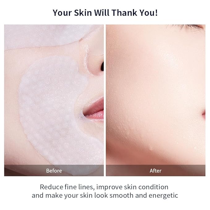 PROF.LING Full-Spectrum Hyaluronic Acid Face Mask – Deep Hydration & Anti-Wrinkle Lifting Sheet Mask, Plumping & Firming Treatment for Fine Lines, Elasticity Boosting Hydrating Facial Mask-5ea