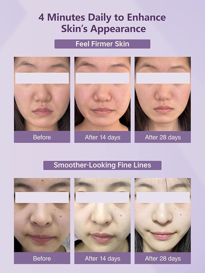 Yuonry 6-in-1 Age-Defying - Eye, Face & Neck Lift & Firm, 5-Color Light Therapy for Face with Microcurrent, Vibration, Heat & Cooling, Skin Care Tool for Youthful & Tightening Skin (Purple)