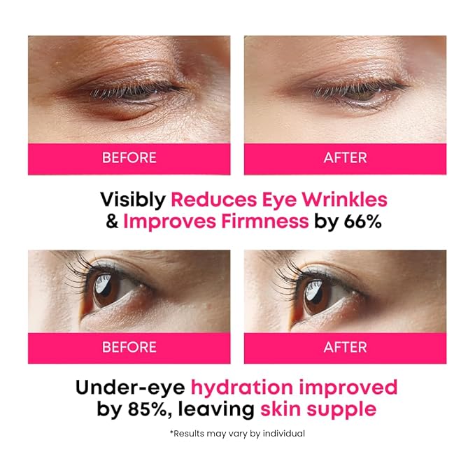 SOMISOME 360° Collagen Eye Masks – Korean Under Eye Patches with Bakuchiol Retinol, Fine Lines & Wrinkle Care, Dark Circle Treatment, 50 Masks
