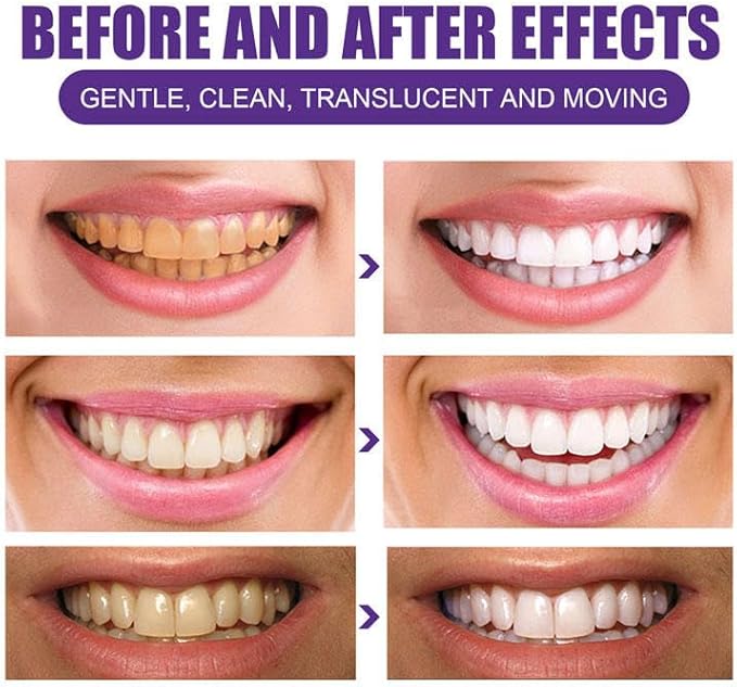 Teeth Whitening Strips, Watermelon Flavor Inspired, Comfort Fit Adhesive, Fresh Taste, 28 Strips in 14 Sealed Pouches, at Home Smile Brightening Routine