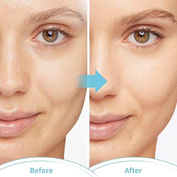 CONBELLA Cold Face Eye Masks Ice Face Mask Hot Cold Compress for Dark Circles, Puffiness, Migraines, Headache, Stress, Redness, Cooling Face Masks for Women Man, Skin Care